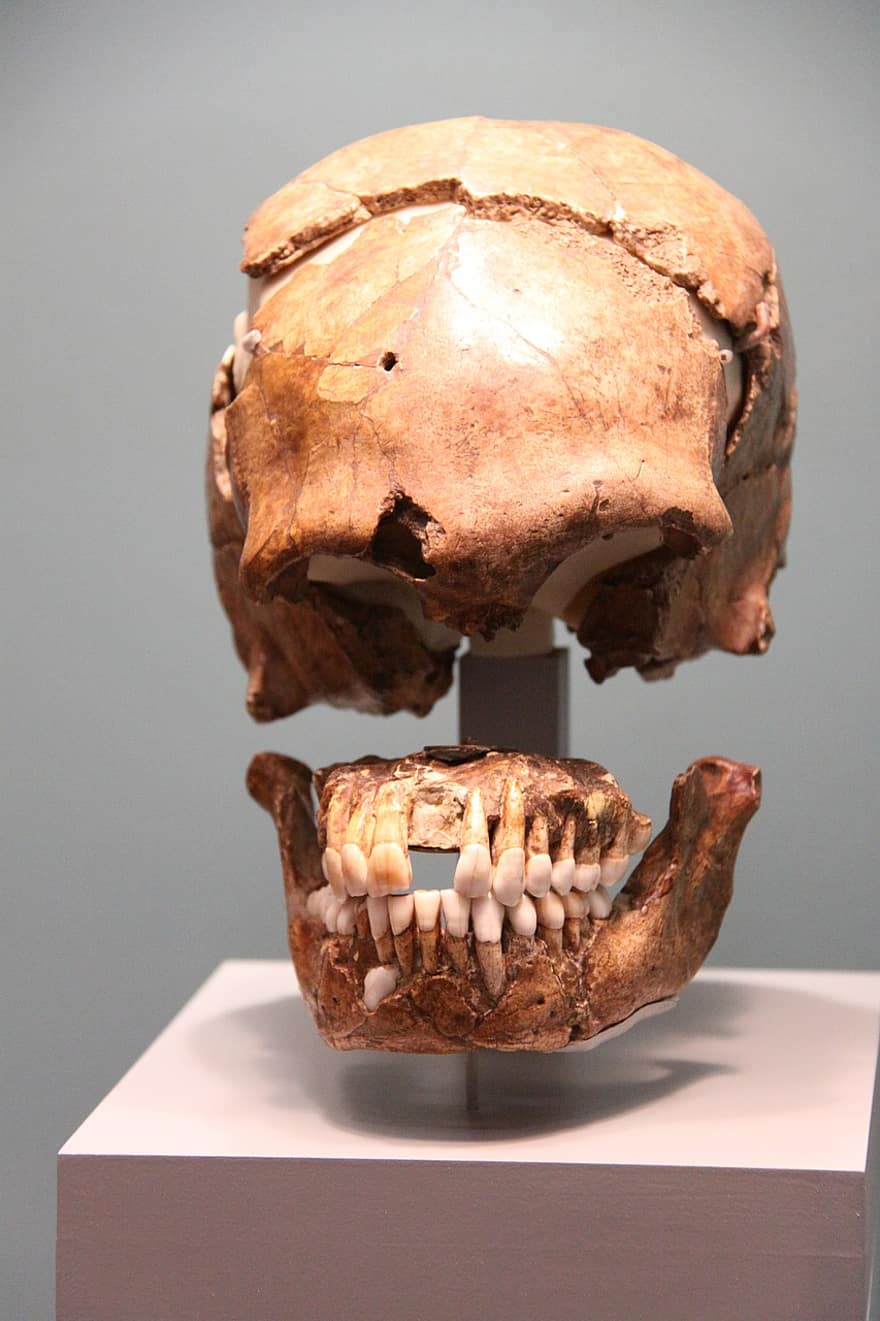 Skull, Frontal