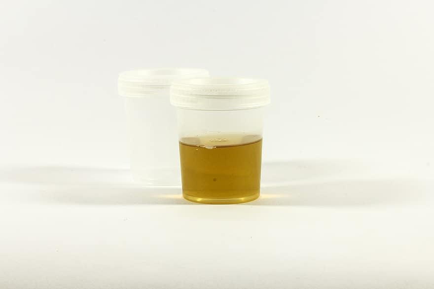 The Test, Urine Container, Urine, Inflammation, Analysis, Medical, Laboratory, Tube, Diagnostics, Research, The Doctor