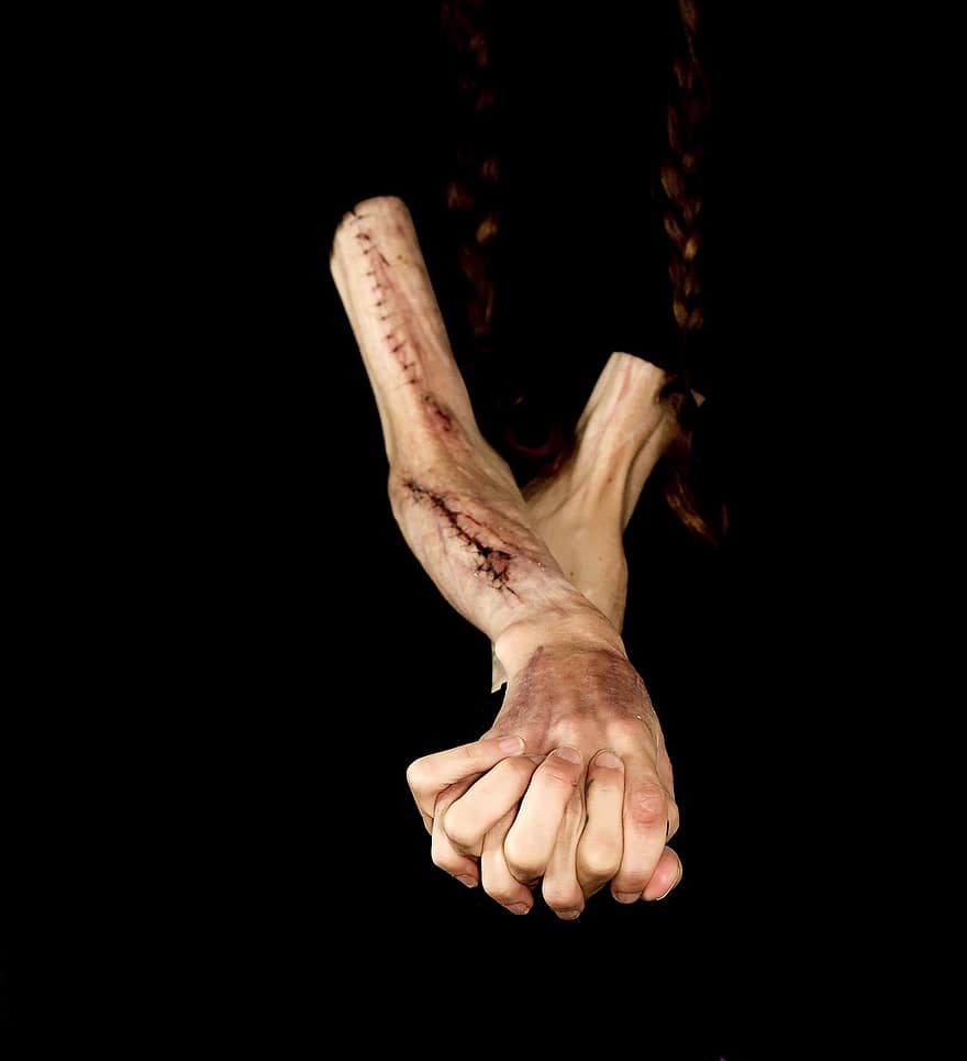 arme, hænder, ar, selvskade, human