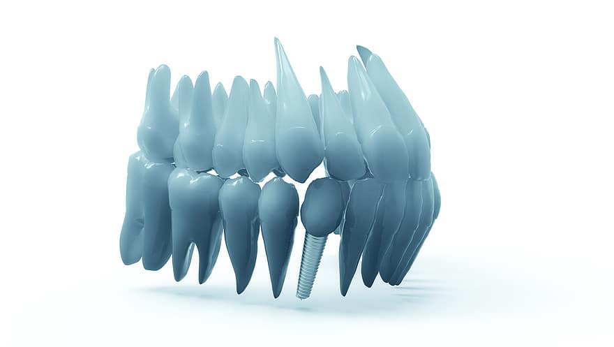 dientes, mandíbula, modelo 3d, ortodoncia