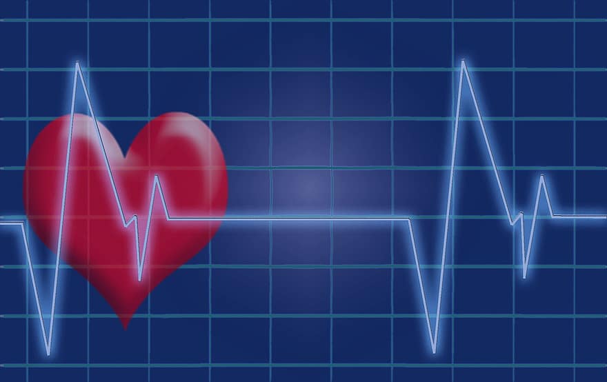 batimento cardiaco, pulso, coração, ecg, eletrocardiograma, médico, te abençoe, curva, freqüência, exame de saúde, pressão sanguínea