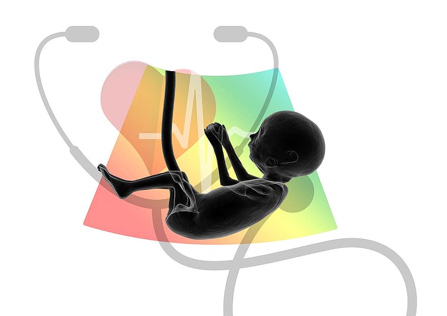 ultrasuono, feto, embrione, placenta, logo, cordone ombelicale, gravidanza, indagine, bambino, incinta, Salute