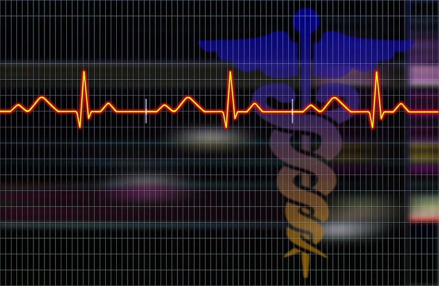 Kardiogramm, Herzschlag, medizinisch, Puls, Pulsfrequenz, Impuls, Gesundheit, Gesundheitswesen, Kardiologie, Cardio, Elektrokardiogramm
