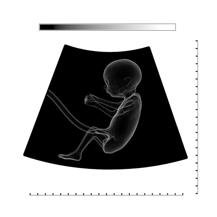 超音波、胎児、胚、胎盤、ロゴ、へその緒、妊娠、調査、赤ちゃん、妊娠している、健康