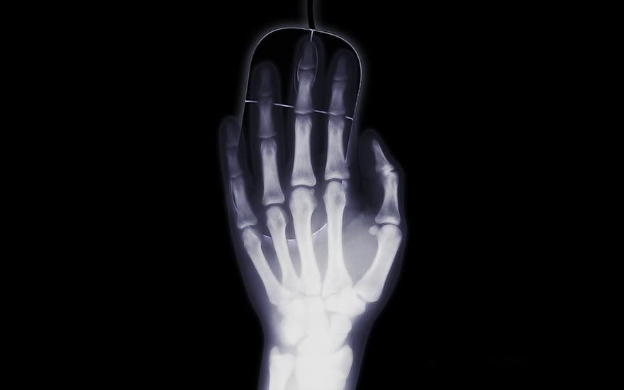 dłoń, promień x, zdjęcie rentgenowskie, mysz, świecenie, komputer, Internet, uzależnienie, promieniowanie