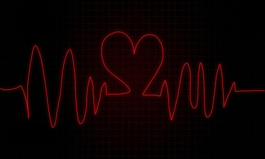 モニター、心臓、ビート、ハートビート、カーディオ、健康、医療の、脈動、心臓病学、健康な心、グラフ