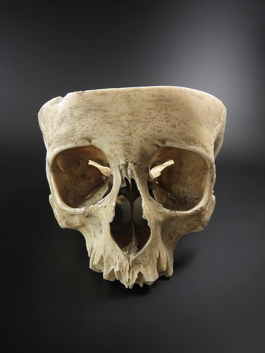 skalle, mänsklig skalle, utställning, på en svart bakgrund, banan, anatomi, ett, Ett