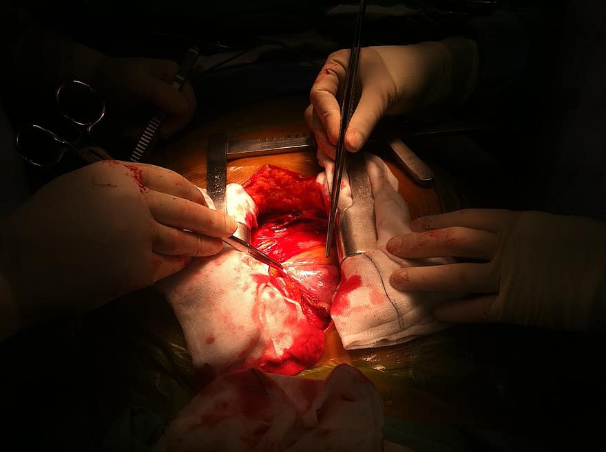 Operation, Open, Heart, Surgery, Medicine, Human, Medical, Person, Operate, Science, Knowledge