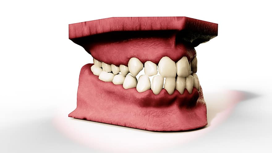 denti, mascella, Modello 3d, ortodonzia