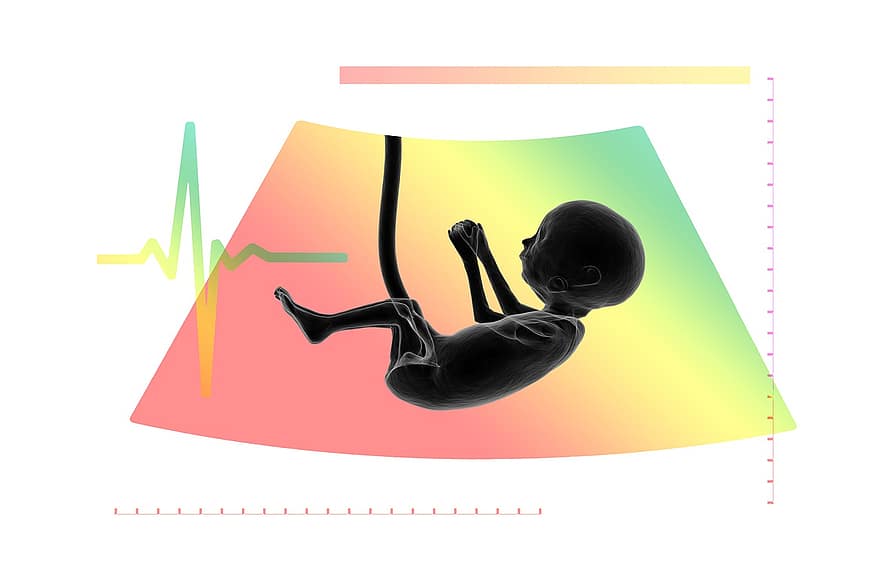ultra-som, feto, embrião, placenta, logotipo, cordão umbilical, gravidez, investigação, bebê, grávida, saúde
