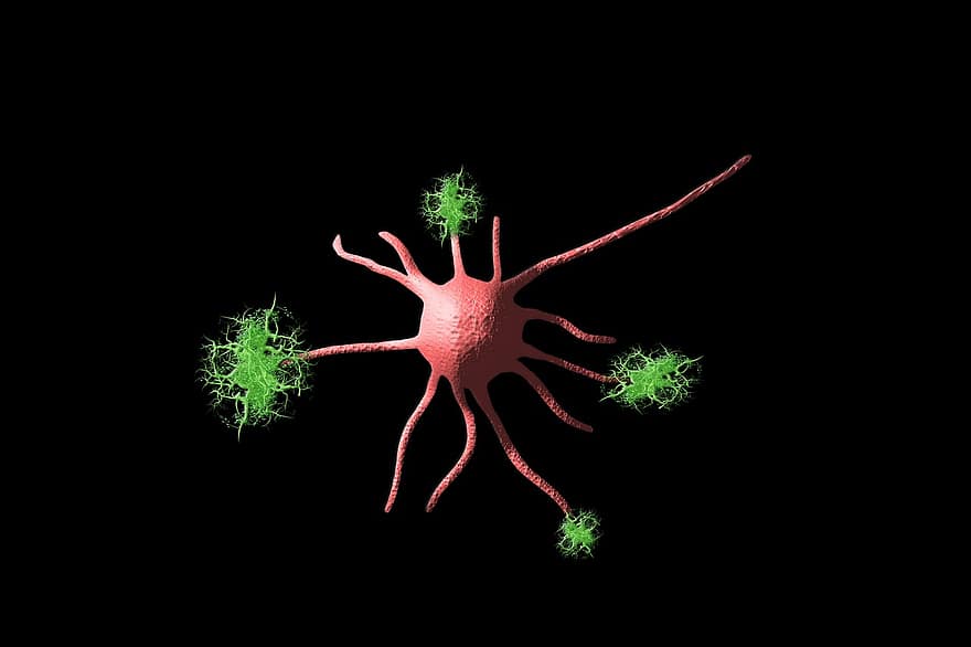 celula nervoasa, neuroni, sistem nervos, nervi, celulă, depozit, plăci, sinapsă, alzheimer, demenţă