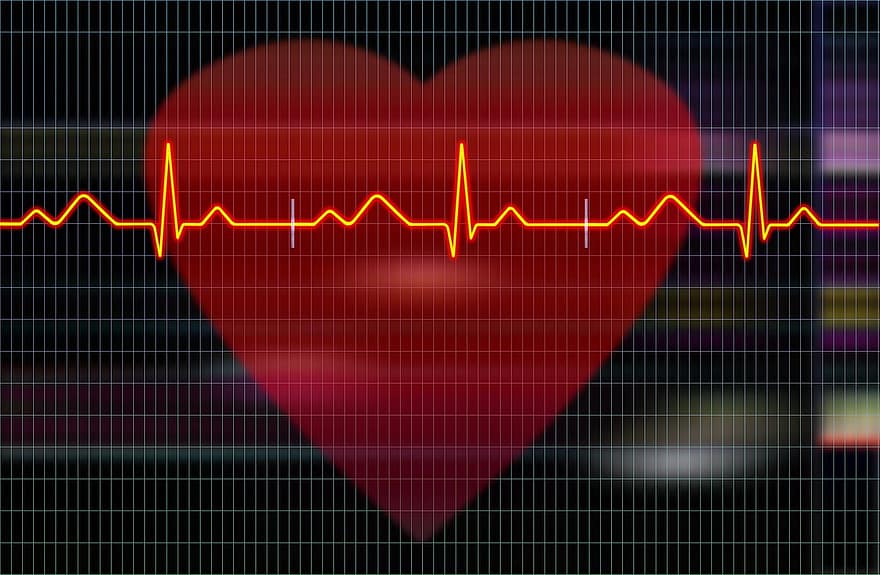 kardiogram, tlukot srdce, srdce, Tepová frekvence, puls, zdraví, zdravotní péče, kardiologie, kardio, elektrokardiogram, ekg