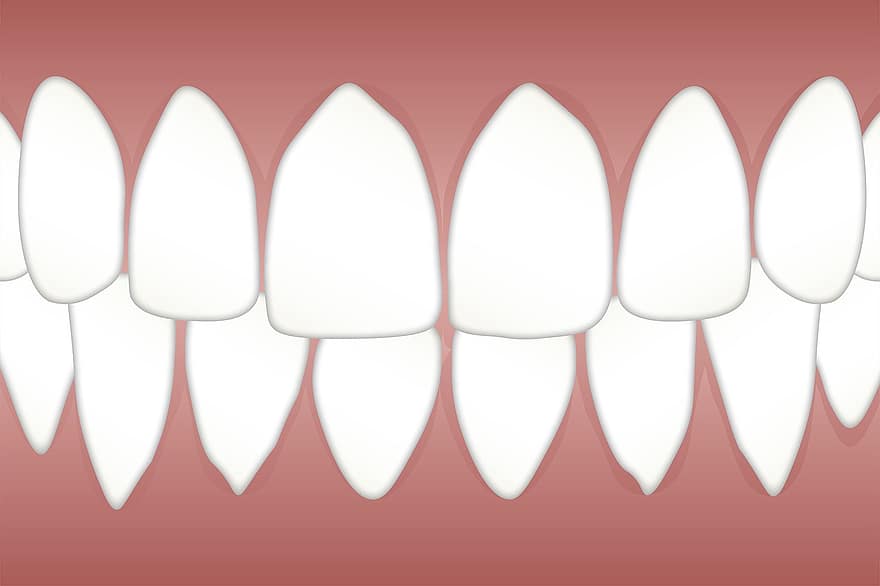 dental, Periodontal, enfermedad, blanco, lugar, lengua, parches, dentista, higiene, dientes, odontología