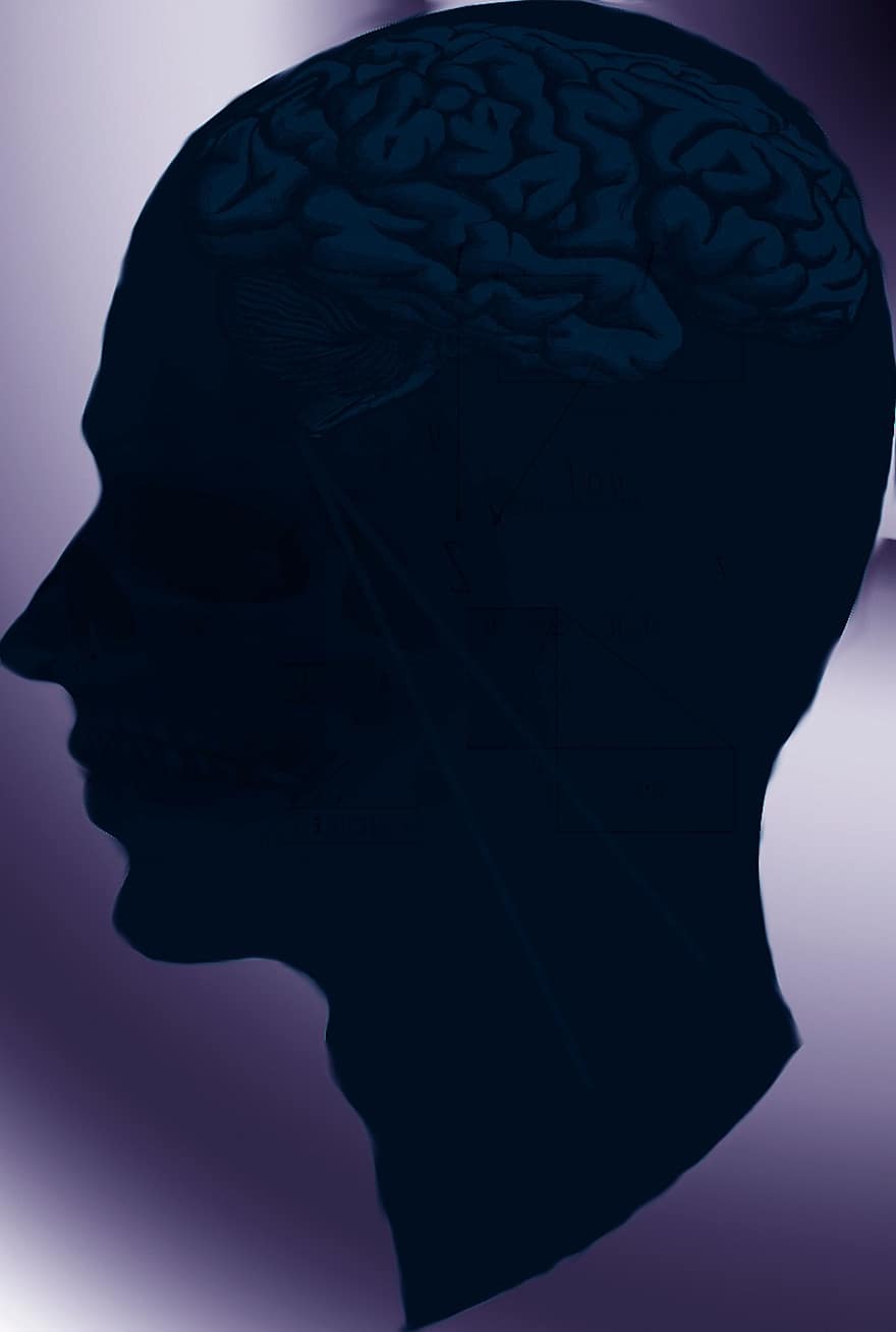 голова, мозг, человек, медицинская, анатомия, Рентгеновский, искусственный, будь другим