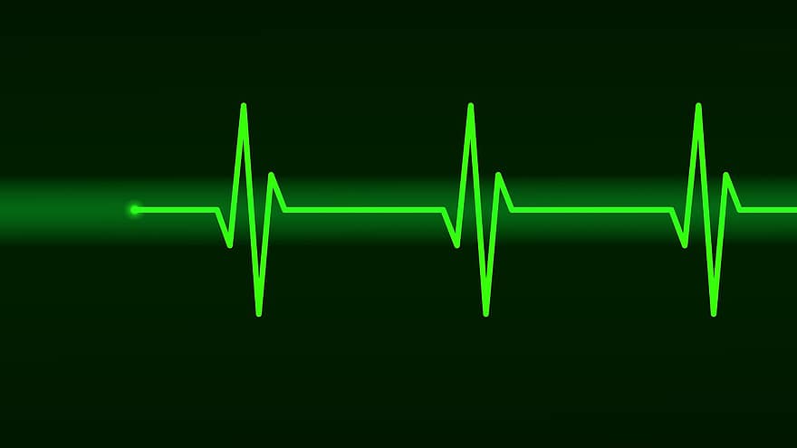 eletrocardiograma, ecg, batimento cardiaco, freqüência, pulso, onda, computação gráfica, sinal, Onda Senoidal, hospital, saúde