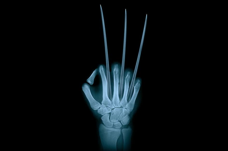 mano, Adamantium, glotón, radiación de rayos x, anatomía, hueso, dedo, pulgar, dedo índice, dedo meñique, expresión