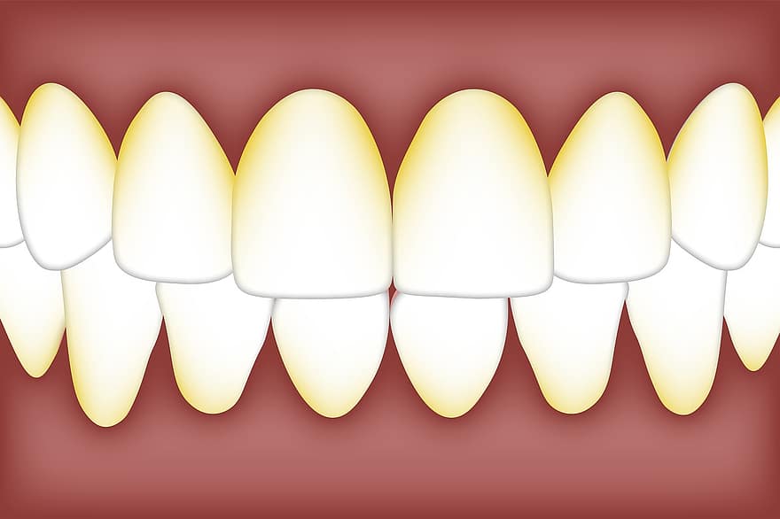 zubní, plaketa, Biofilm, bakterie, pusa, zubní kámen, Mikrobiální plak, Orální biofilm, zuby, zub, molární