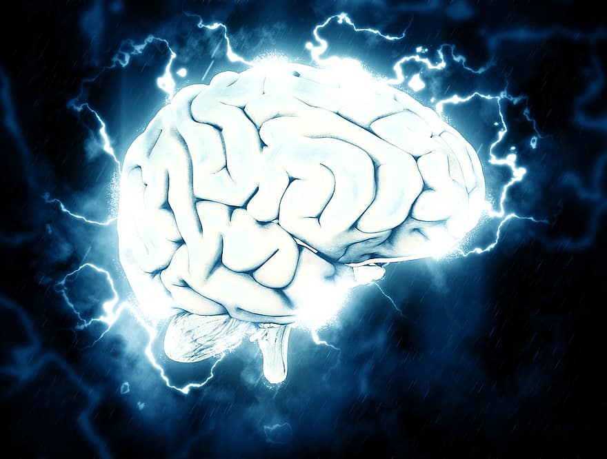 mozek, elektrický, znalost, migréna, bolest hlavy, stres
